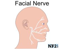 Facial Nerve Damage