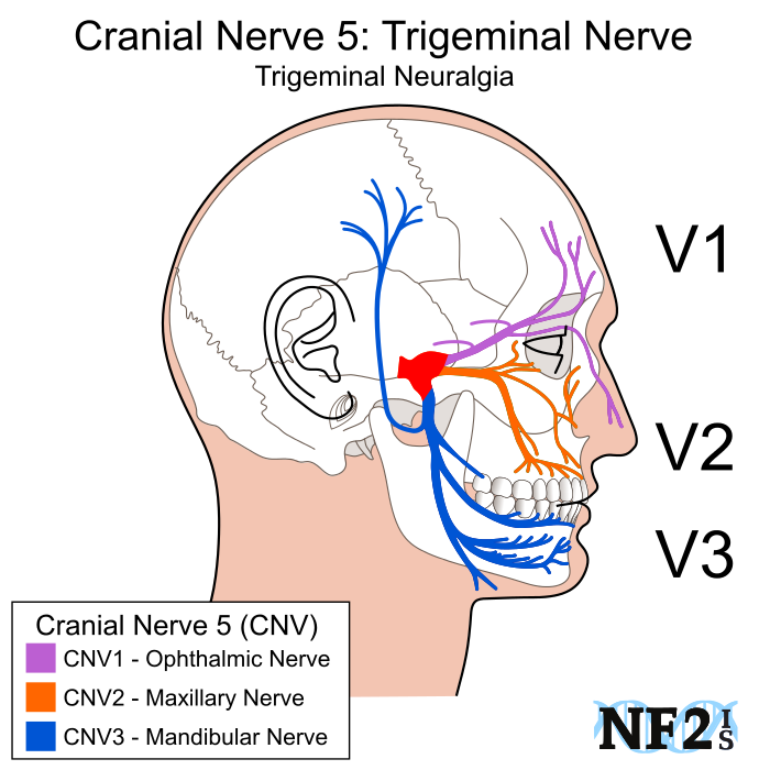 Mandibular Nerve (V3)