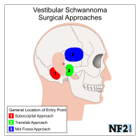 NF2 Issue