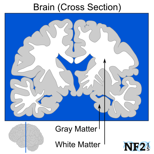 Brain Cross-Section