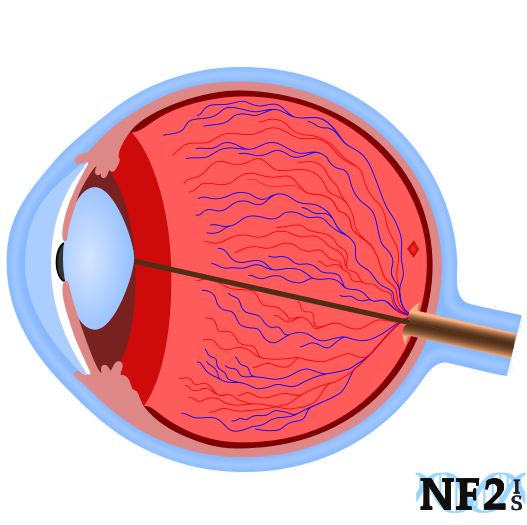 The Human Eye