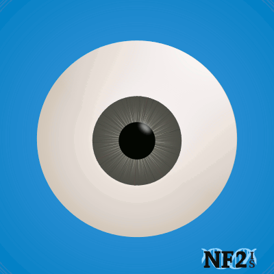 Nystagmus