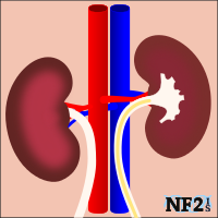 NF2 Issue