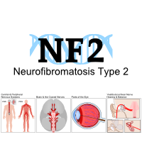 NF2 Issue