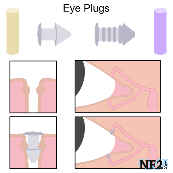 Eye Plug